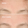 Product Clarifying Do-Over Peel 30ml thumbnail image