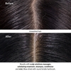 Product Scalp Solutions Exfoliating Scalp Treatment 150ml thumbnail image