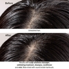 Product Scalp Solutions Exfoliating Scalp Treatment 150ml thumbnail image