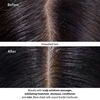 Product Scalp Solutions Balancing Shampoo 1000ml thumbnail image