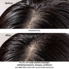 Product Scalp Solutions Balancing Shampoo 1000ml thumbnail image