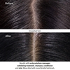 Product Scalp Solutions Balancing Shampoo 200ml thumbnail image