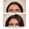 Product Invati Ultra Advanced Serum 150ml thumbnail image