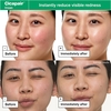 Product Cicapair™ Redness Rescue Regimen Set thumbnail image