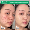 Product Cicapair™ Redness Rescue Regimen Set thumbnail image