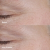 Product Smart Clinical Repair™ AM/PM Retinoid Balm 3g thumbnail image