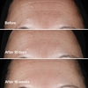 Product Wrinkle-Fighting Routine Skincare Set thumbnail image