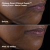 Product Smart Clinical Repair™ Face + Neck Lift Routine Set thumbnail image
