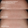 Product Smart Clinical Repair™ Face + Neck Lift Routine Set thumbnail image
