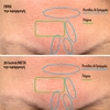 Product Hyaluronic Filler Instant Correction Concentrate 20ml thumbnail image