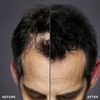 Product Toppik Spray Applicator thumbnail image