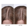 Product Dry Scalp Treatment 45ml thumbnail image