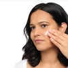 Product Azelaic Acid Suspension 10% 30ml thumbnail image