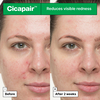 Product Cicapair™ So Soothing Treatment 30ml thumbnail image