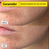 Product Ceramidin™ Ectoin®-Infused Cream 50ml thumbnail image