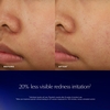 Product Advanced Night Repair - Recovery Treatment Essence Lotion 100ml thumbnail image