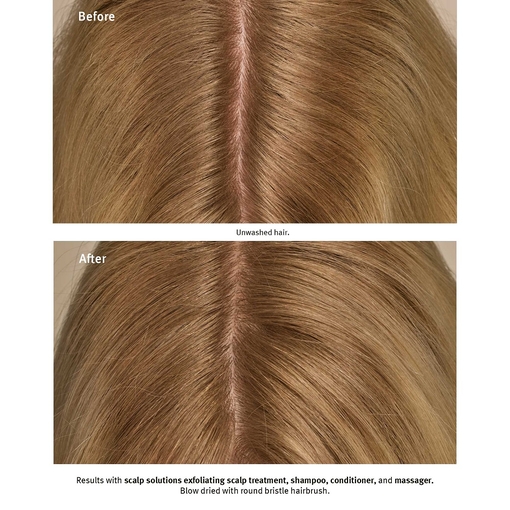 Product Scalp Solutions Exfoliating Scalp Treatment 150ml base image