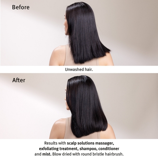 Product Scalp Solutions Exfoliating Scalp Treatment 150ml base image