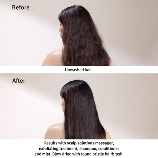 Product Scalp Solutions Exfoliating Scalp Treatment 150ml base image