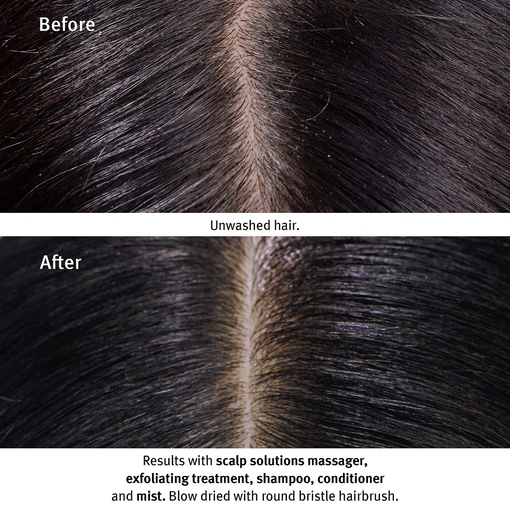 Product Scalp Solutions Exfoliating Scalp Treatment 150ml base image