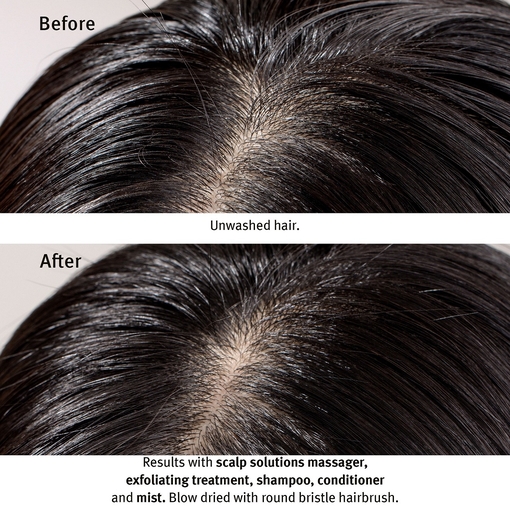 Product Scalp Solutions Exfoliating Scalp Treatment 150ml base image
