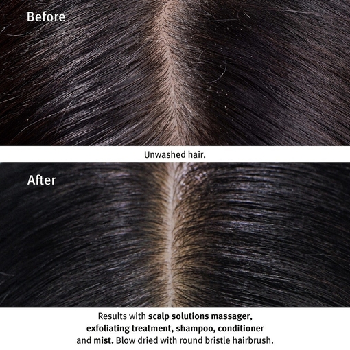 Product Scalp Solutions Balancing Shampoo 1000ml base image