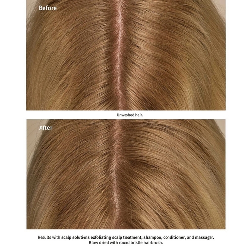 Product Scalp Solutions Balancing Shampoo 1000ml base image