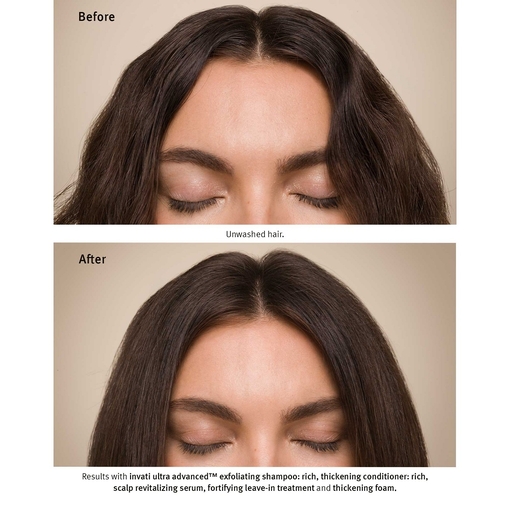 Product Invati Ultra Advanced Thickening Conditioner Rich 200ml base image