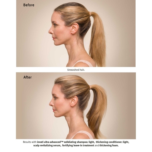 Product Invati Ultra Advanced Serum 150ml base image
