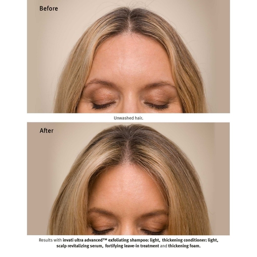 Product Invati Ultra Advanced Serum 150ml base image