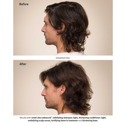 Product Invati Ultra Advanced Serum 150ml base image