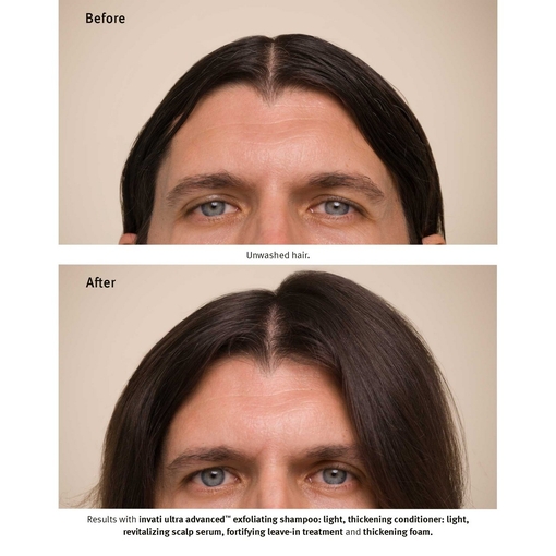 Product Invati Ultra Advanced Fortifying Leave In Treatment 25ml base image