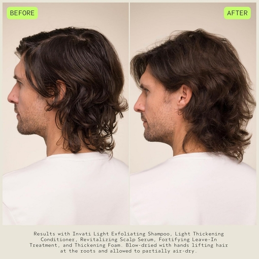 Product Invati Ultra Advanced™ Revitalizing Scalp Serum 30ml base image