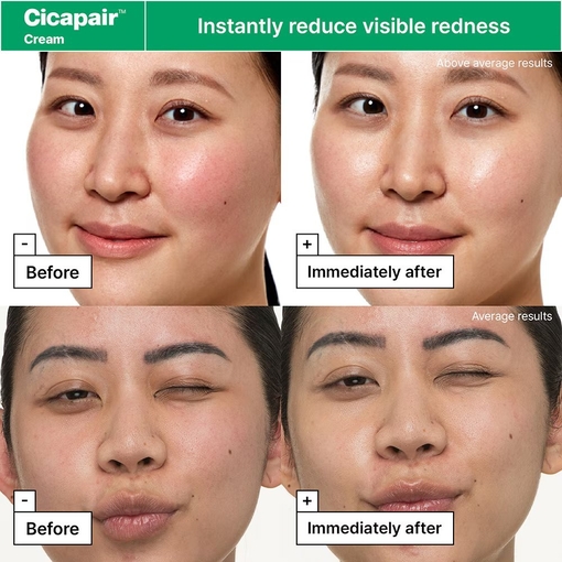 Product Cicapair™ Redness Rescue Regimen Set base image