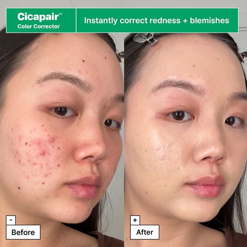 Product Cicapair™ Redness Rescue Regimen Set base image