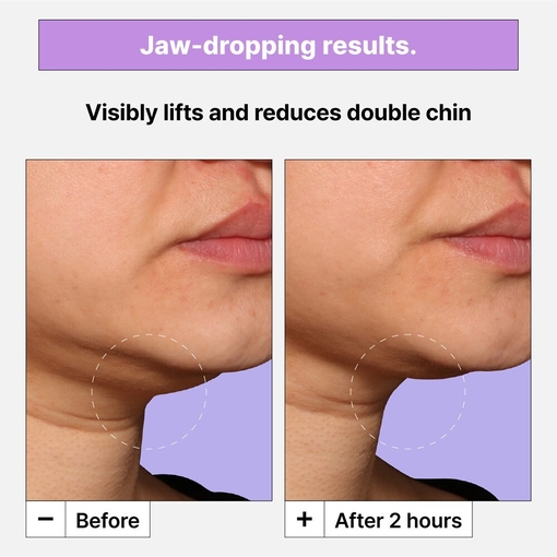 Product Cryo-V Jawline Lifting Mask 8g base image