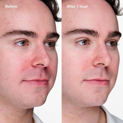 Product Anti-Blemish Solutions Clinical™ Advanced Clearing Gel 20ml base image