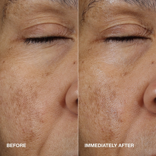 Product Moisture Surge Value Set base image