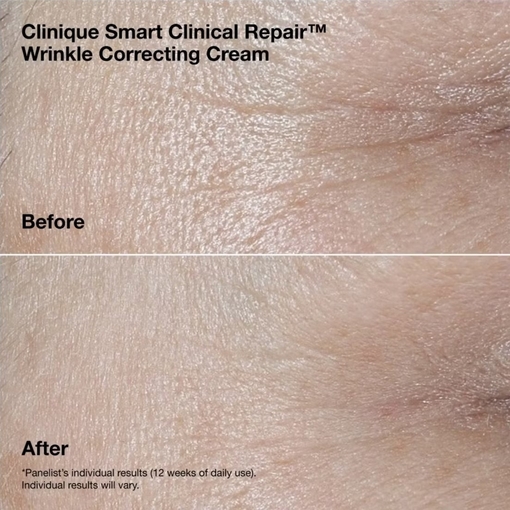 Product Smart Clinical Repair™ Wrinkle Correcting Routine Set base image
