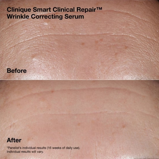 Product Smart Clinical Repair™ Wrinkle Correcting Routine Set base image
