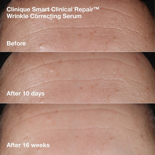 Product Smart Clinical Repair™ Face + Neck Lift Routine Set base image