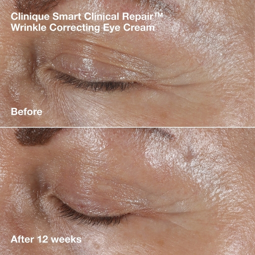 Product Smart Clinical Repair™ Face + Neck Lift Routine Set base image