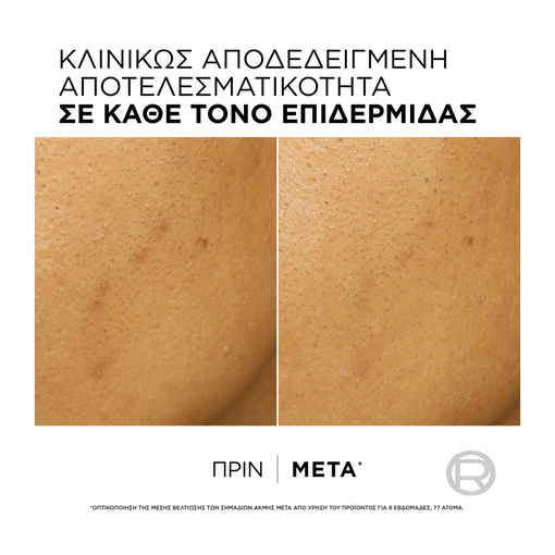 Product Bright Reveal Peeling Προσώπου με Νιασιναμίδη 25ml base image