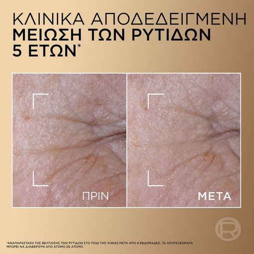 Product Age Perfect Ορός Προσώπου Εντατικής Αντιγήρανσης 30ml base image