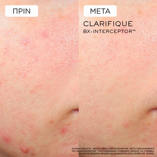 Product Clarifique Bx-Interceptor™ - Rapid Blemish-Clearing Treatment 30ml base image