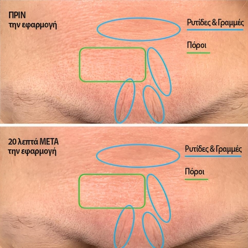 Product Hyaluronic Filler Instant Correction Concentrate 20ml base image