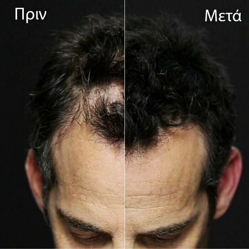 Product Hair Building Fibers Light Blonde 27.5g base image