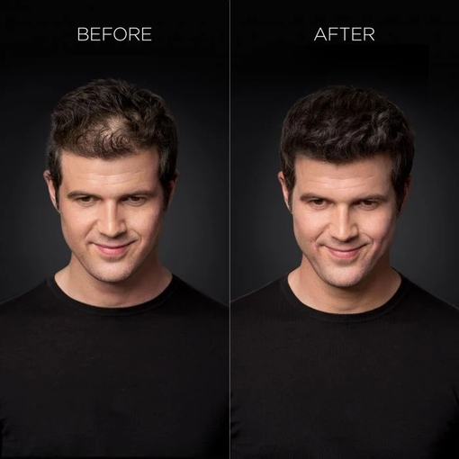Product Colored Hair Thickener Medium Brown 144g base image
