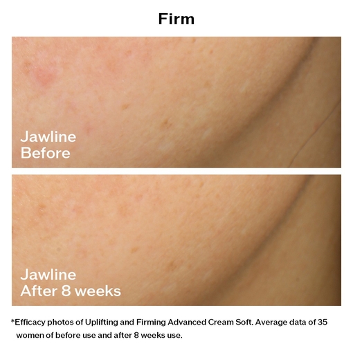 Product Vital Perfection Uplifting And Firming Advanced Soft Cream - Refillable 50ml base image