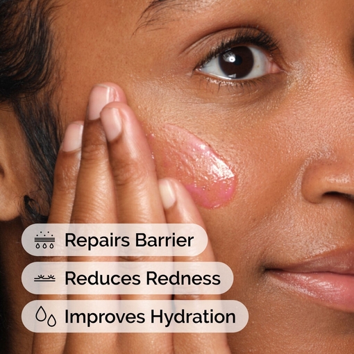 Product Soothing & Barrier Support Serum 30ml base image
